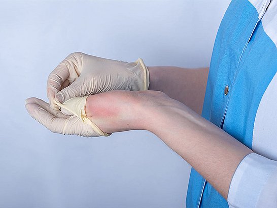 Eine Kontaktdermatitis kann zum einen toxisch, d.h. durch die Einwirkung eines die Haut schädigenden Stoffes bedingt sein, oder aber allergisch, durch eine individuelle Sensibilisierung gegenüber einem ansonsten unschädlichen Stoff ausgelöst sein.